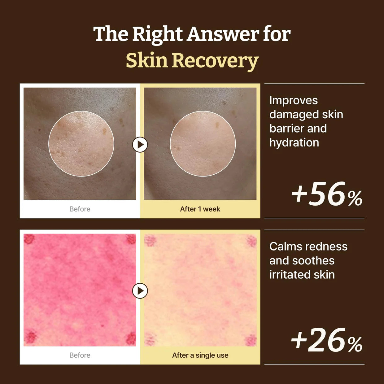 DR. REJU-ALL - Advanced PDRN Rejuvenating Cream