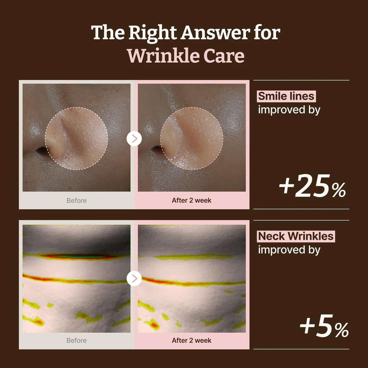 DR. REJU-ALL - Advanced PDRN Rejuvenating Mask (1 Mask)